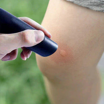Anti-Itch Relief Pen for Mosquito & Insect Bites, Portable Physical Itch Relief Stick, Instant Bite Relief Tool for Adults & Children, Black